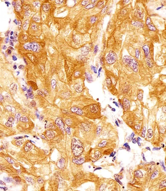 IHC-P - DKK1 Antibody AW5504-U100